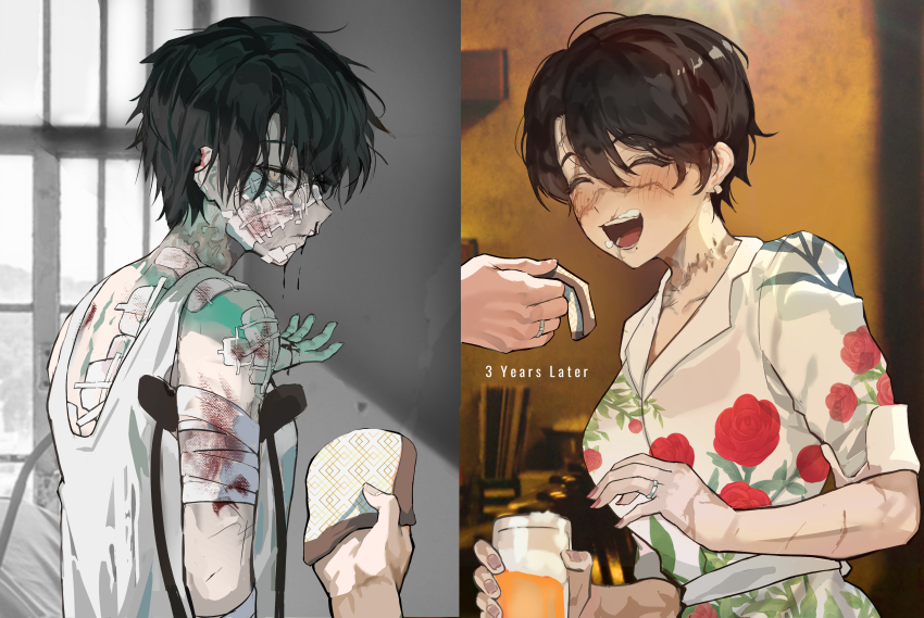 1girl 1other :d ^_^ absurdres alcohol bandage_on_nose bandaged_arm bandages beer before_and_after black_hair blood blush bruise closed_eyes closed_mouth collared_shirt commentary crutch cup cuts earrings english_commentary english_text floral_print floral_print_shirt gauze gauze_on_back gauze_on_cheek gauze_on_shoulder hand_up handkerchief happy highres holding holding_cup holding_handkerchief injury jewelry mole mole_under_mouth notched_ear open_mouth original out_of_frame park_ongjol partially_colored pov ring rose_print scar scar_across_eye scar_on_arm scar_on_face scar_on_neck scarred_tomboy_maid_(park_ongjol) shirt short_hair smile split_screen tank_top upper_body wedding_ring white_shirt white_tank_top yellow_eyes