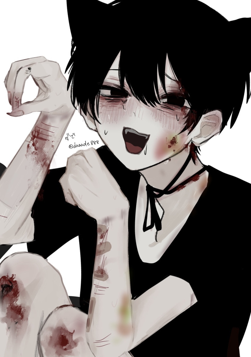 1boy :d animal_ears artist_name bags_under_eyes bandaid bandaid_on_arm bishounen black_eyes black_hair black_ribbon black_shirt bleeding blood blood_in_hair blood_on_arm blood_on_face blood_on_hands blood_on_neck bloody_tears blush bruise bruise_on_arm bruise_on_knee bruise_on_leg bruise_on_neck bruise_on_wrist cheek_injury crew_neck cuts daaade888 drooling empty_eyes fake_animal_ears fingernails furrowed_brow hair_between_eyes hand_injury hands_up highres injury knee_injury knees_up long_fingernails looking_at_viewer male_focus neck_ribbon open_mouth original paw_pose ribbon self-harm self-harm_scar shirt short_hair short_sleeves sidelocks signature simple_background sitting smile solo sweat too_many_bandaids twitter_username upper_body variant_set wavy_mouth white_background wrist_cutting